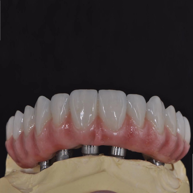 Многослойный блок циркония 95 мм 4D Pro