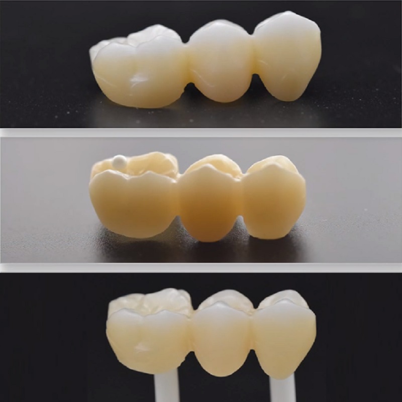 98mm 4D بلوك الزركونيا متعدد الطبقات 